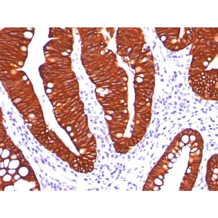 Immunohistochemistry - Anti-Cytokeratin 19 Antibody [A53-B/A2.26] - BSA and Azide free (A252388) - Antibodies.com