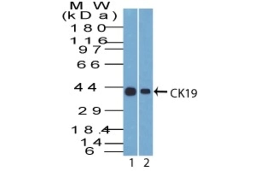 Western Blot - Anti-Cytokeratin 19 Antibody [A53-B/A2.26] - BSA and Azide free (A252388) - Antibodies.com