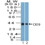 Western Blot - Anti-Cytokeratin 19 Antibody [A53-B/A2.26] - BSA and Azide free (A252388) - Antibodies.com