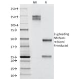 SDS-PAGE - Anti-Cytokeratin 19 Antibody [A53-B/A2.26] - BSA and Azide free (A252388) - Antibodies.com