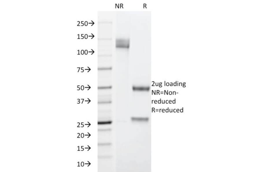 SDS-PAGE - Anti-Cytokeratin 19 Antibody [SPM266] - BSA and Azide free (A252389) - Antibodies.com