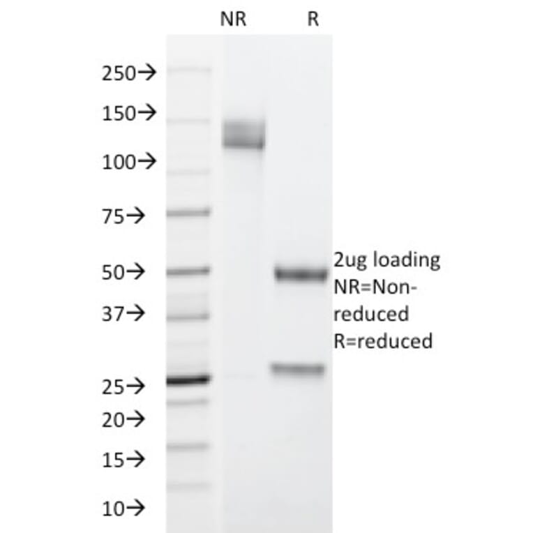 SDS-PAGE - Anti-Cytokeratin 19 Antibody [SPM266] - BSA and Azide free (A252389) - Antibodies.com
