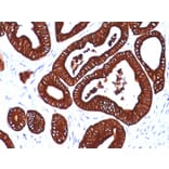Immunohistochemistry - Anti-Cytokeratin 19 Antibody [BA17] - BSA and Azide free (A252390) - Antibodies.com