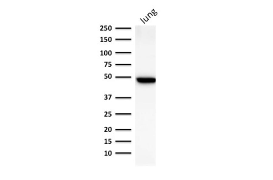 Western Blot - Anti-Cytokeratin 19 Antibody [BA17] - BSA and Azide free (A252390) - Antibodies.com