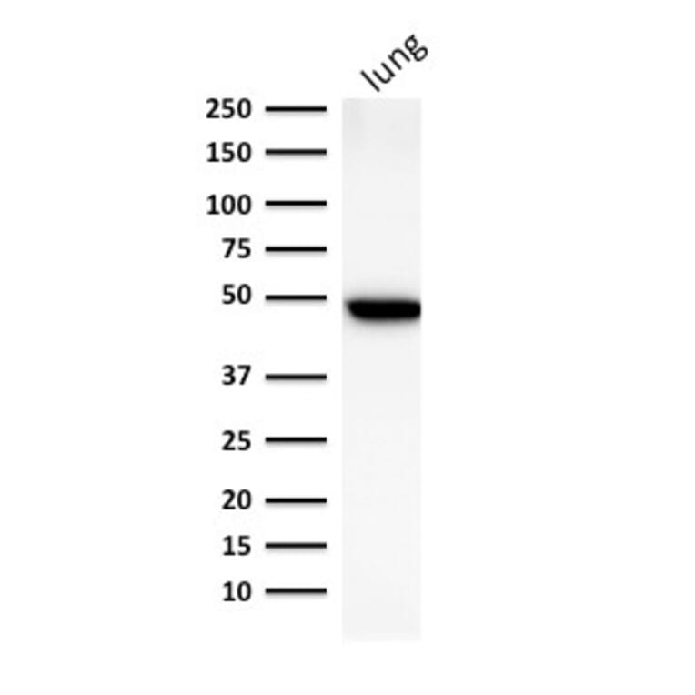 Western Blot - Anti-Cytokeratin 19 Antibody [BA17] - BSA and Azide free (A252390) - Antibodies.com