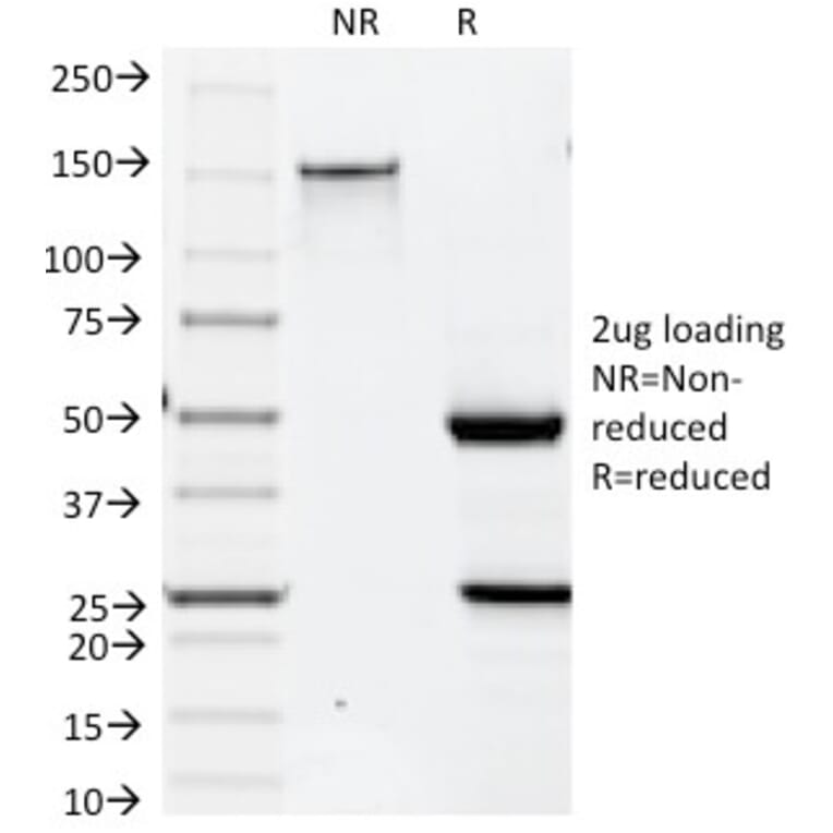 SDS-PAGE - Anti-Cytokeratin 19 Antibody [BA17] - BSA and Azide free (A252390) - Antibodies.com