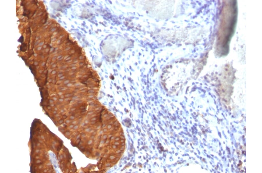 Immunohistochemistry - Anti-Cytokeratin 19 Antibody [SPM561] - BSA and Azide free (A252391) - Antibodies.com