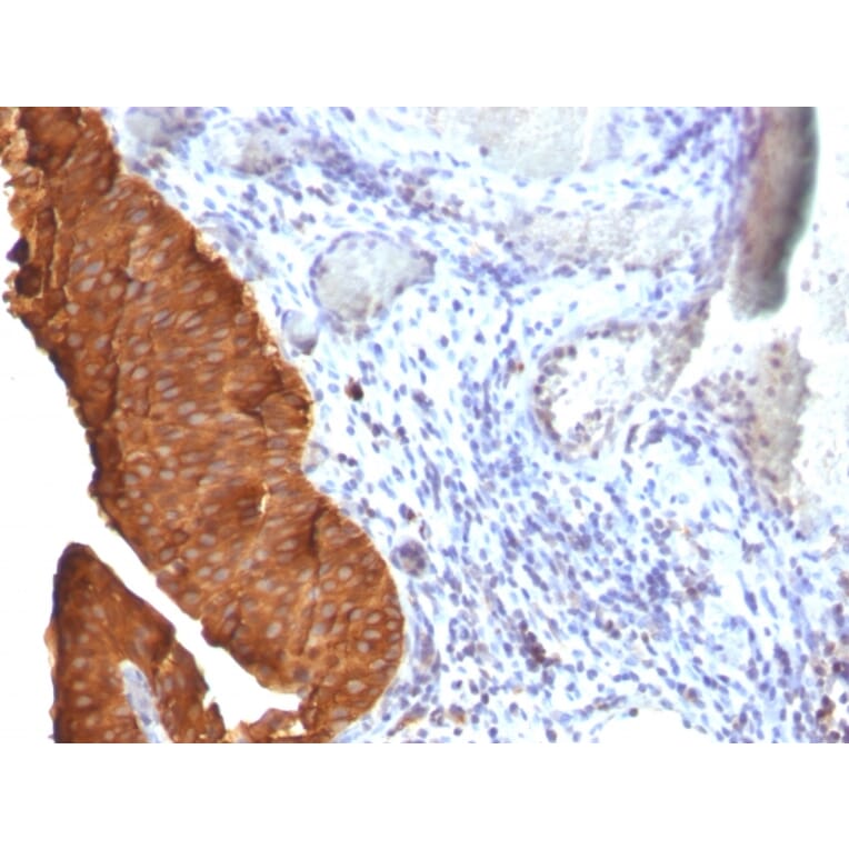 Immunohistochemistry - Anti-Cytokeratin 19 Antibody [SPM561] - BSA and Azide free (A252391) - Antibodies.com