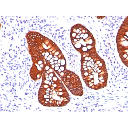 Immunohistochemistry - Anti-Cytokeratin 19 Antibody [A53-B/A2.26 + BA17] - BSA and Azide free (A252391) - Antibodies.com