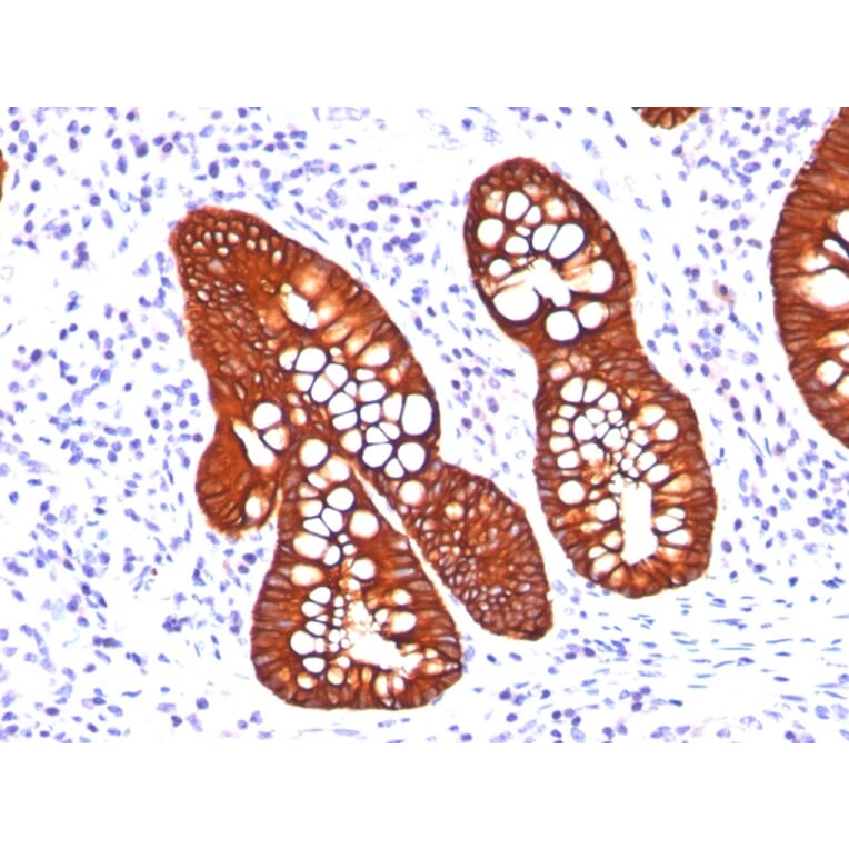 Immunohistochemistry - Anti-Cytokeratin 19 Antibody [A53-B/A2.26 + BA17] - BSA and Azide free (A252391) - Antibodies.com