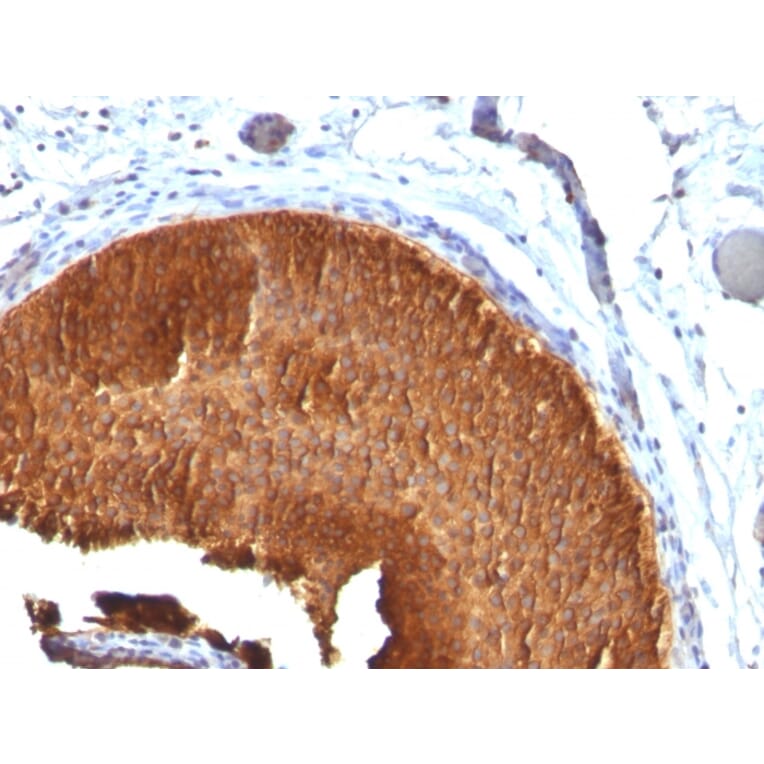 Immunohistochemistry - Anti-Cytokeratin 19 Antibody [KRT19/799] - BSA and Azide free (A252393) - Antibodies.com