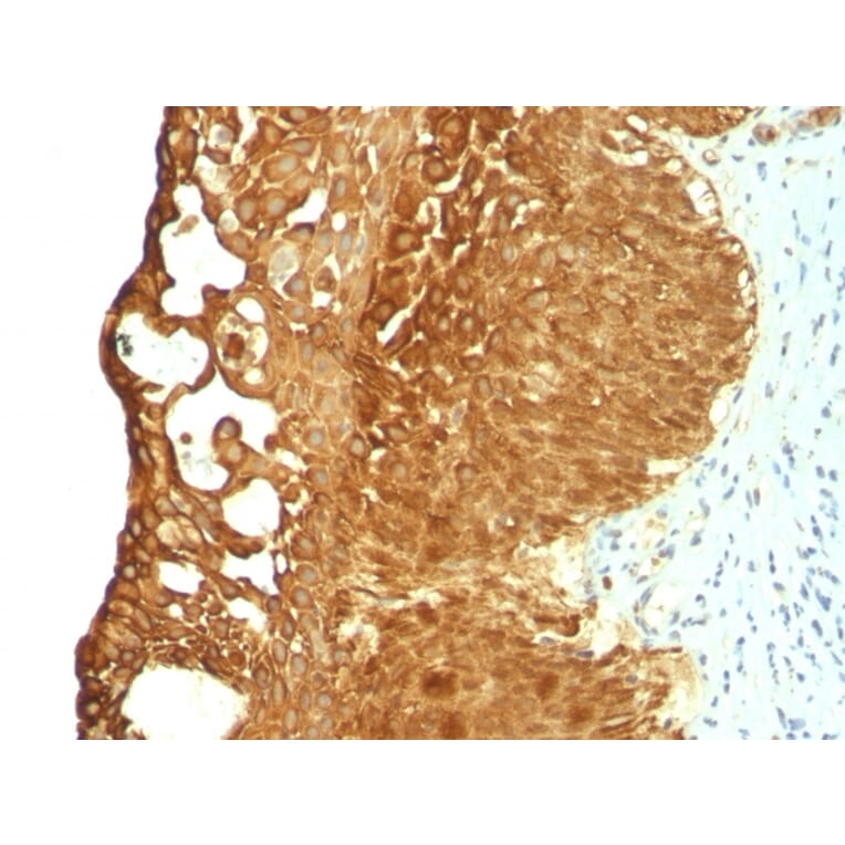 Immunohistochemistry - Anti-Cytokeratin 19 Antibody [KRT19/799] - BSA and Azide free (A252393) - Antibodies.com