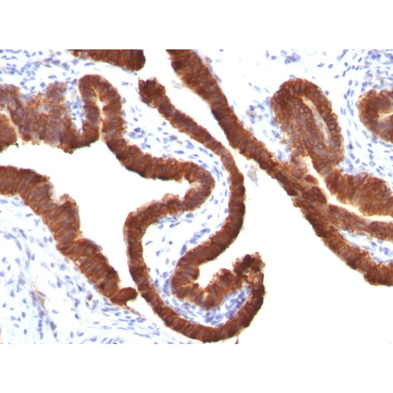 Immunohistochemistry - Anti-Cytokeratin 19 Antibody [KRT19/799] - BSA and Azide free (A252393) - Antibodies.com