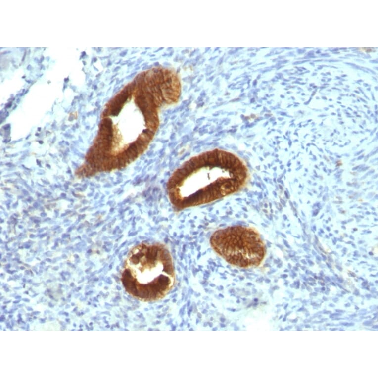Immunohistochemistry - Anti-Cytokeratin 19 Antibody [KRT19/799] - BSA and Azide free (A252393) - Antibodies.com