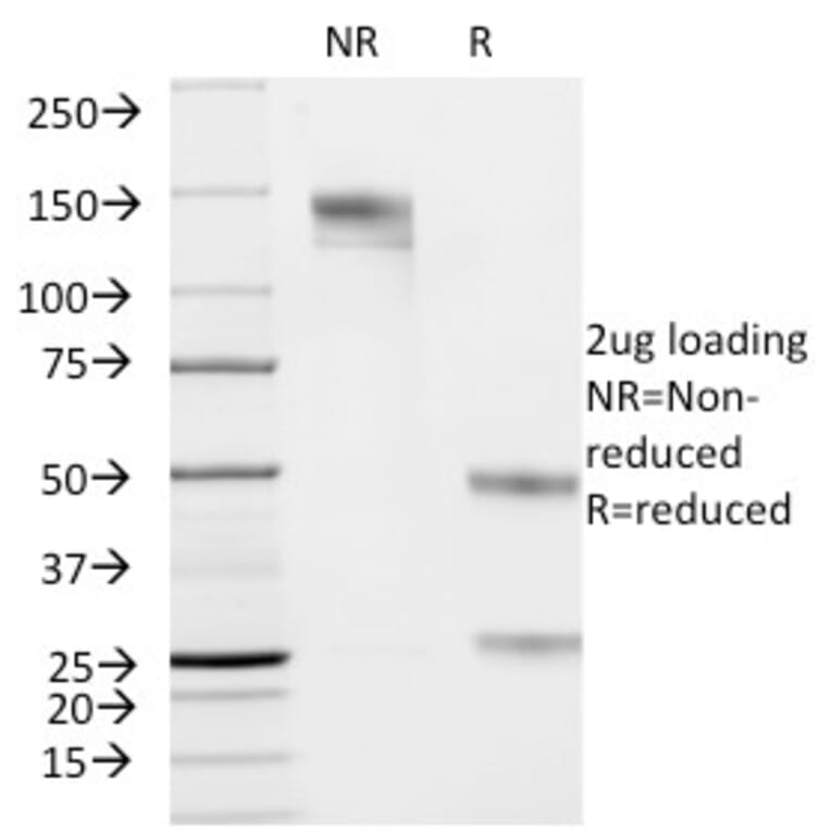 SDS-PAGE - Anti-Cytokeratin 19 Antibody [KRT19/799] - BSA and Azide free (A252393) - Antibodies.com