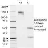 SDS-PAGE - Anti-Cytokeratin 19 Antibody [KRT19/799] - BSA and Azide free (A252393) - Antibodies.com
