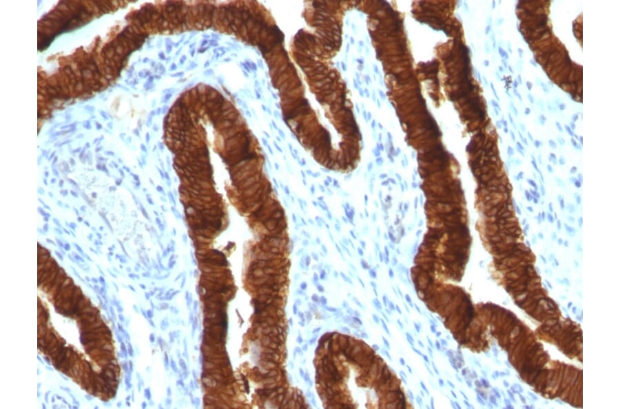 Immunohistochemistry - Anti-Cytokeratin 19 Antibody [KRT19/800] - BSA and Azide free (A252394) - Antibodies.com