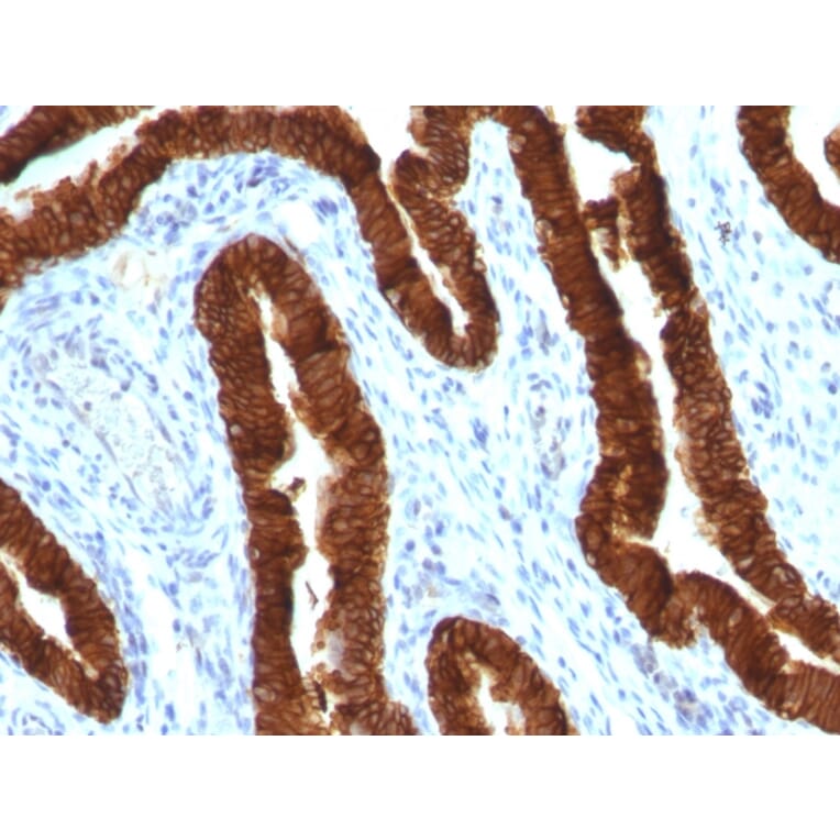 Immunohistochemistry - Anti-Cytokeratin 19 Antibody [KRT19/800] - BSA and Azide free (A252394) - Antibodies.com