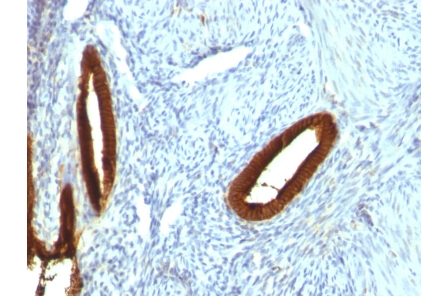 Immunohistochemistry - Anti-Cytokeratin 19 Antibody [KRT19/800] - BSA and Azide free (A252394) - Antibodies.com