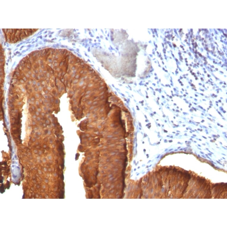 Immunohistochemistry - Anti-Cytokeratin 19 Antibody [KRT19/800] - BSA and Azide free (A252394) - Antibodies.com