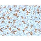 Immunohistochemistry - Anti-Cytokeratin 19 Antibody [KRT19/800] - BSA and Azide free (A252394) - Antibodies.com