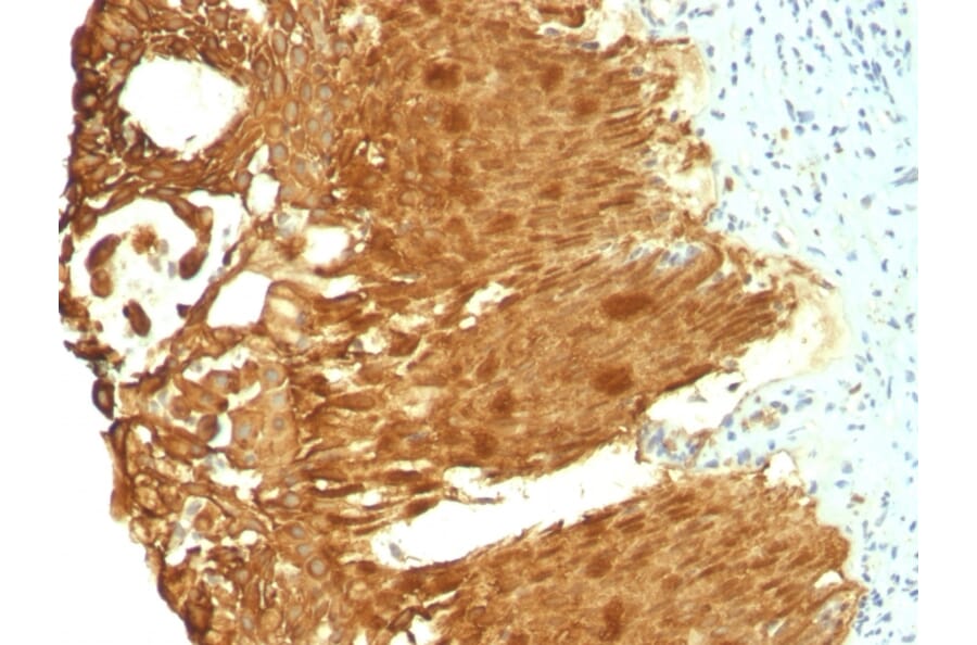 Immunohistochemistry - Anti-Cytokeratin 19 Antibody [KRT19/799 + KRT19/800] - BSA and Azide free (A252396) - Antibodies.com