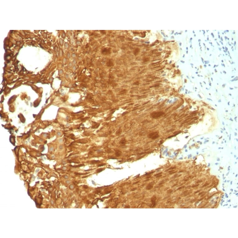 Immunohistochemistry - Anti-Cytokeratin 19 Antibody [KRT19/799 + KRT19/800] - BSA and Azide free (A252396) - Antibodies.com