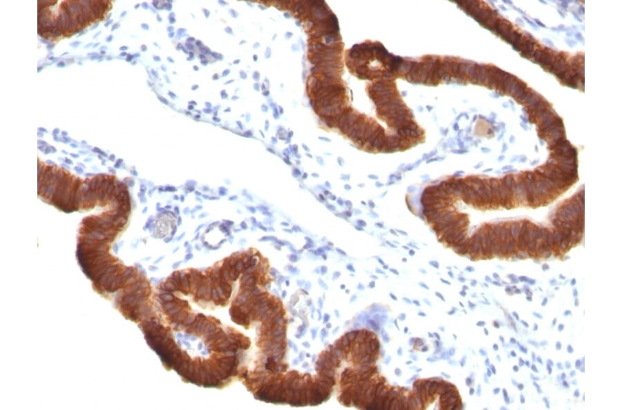 Immunohistochemistry - Anti-Cytokeratin 19 Antibody [KRT19/799 + KRT19/800] - BSA and Azide free (A252396) - Antibodies.com