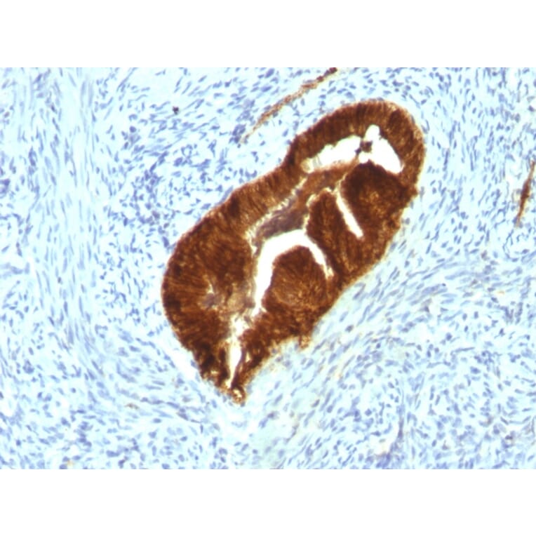 Immunohistochemistry - Anti-Cytokeratin 19 Antibody [KRT19/799 + KRT19/800] - BSA and Azide free (A252396) - Antibodies.com