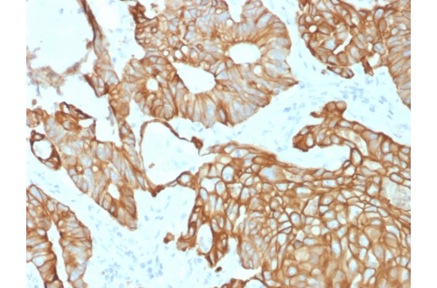 Immunohistochemistry - Anti-Cytokeratin 19 Antibody [rKRT19/800] - BSA and Azide free (A252396) - Antibodies.com