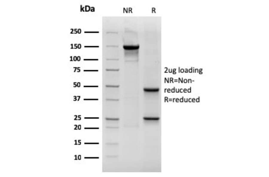 SDS-PAGE - Anti-Cytokeratin 19 Antibody [rKRT19/800] - BSA and Azide free (A252397) - Antibodies.com
