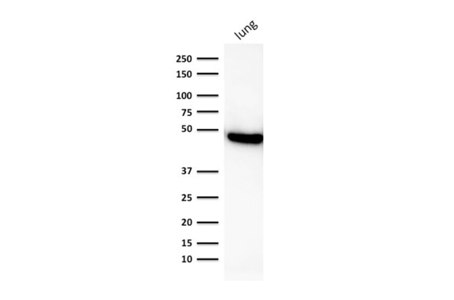 Western Blot - Anti-Cytokeratin 19 Antibody [rKRT19/800] - BSA and Azide free (A252397) - Antibodies.com