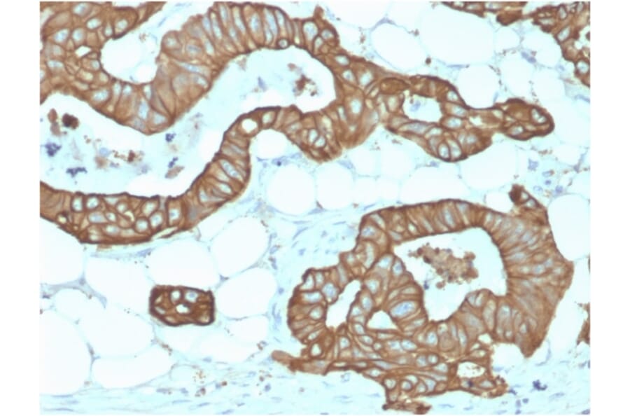 Immunohistochemistry - Anti-Cytokeratin 19 Antibody [KRT19/1959R] - BSA and Azide free (A252397) - Antibodies.com
