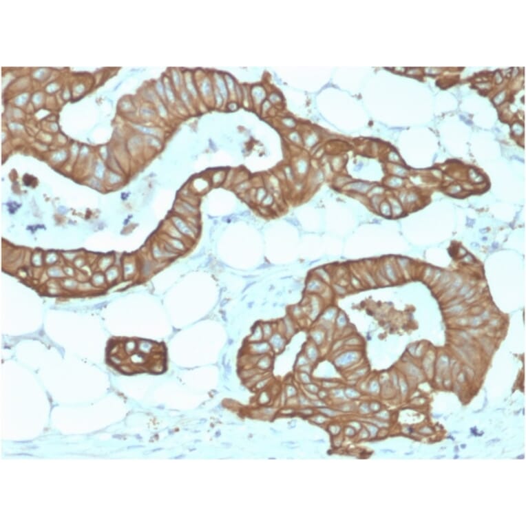 Immunohistochemistry - Anti-Cytokeratin 19 Antibody [KRT19/1959R] - BSA and Azide free (A252397) - Antibodies.com