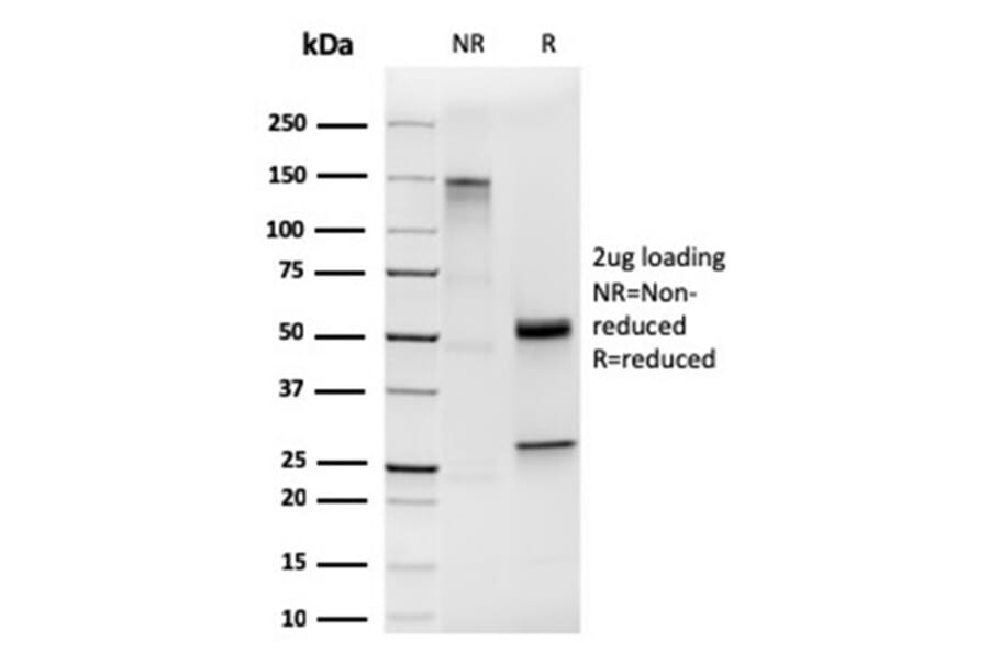 SDS-PAGE - Anti-Cytokeratin 19 Antibody [KRT19/1959R] - BSA and Azide free (A252398) - Antibodies.com