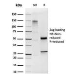 SDS-PAGE - Anti-Cytokeratin 19 Antibody [KRT19/1959R] - BSA and Azide free (A252398) - Antibodies.com