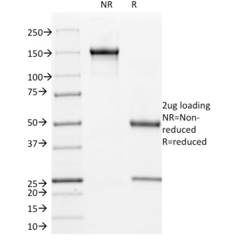 SDS-PAGE - Anti-L1CAM Antibody [UJ127] - BSA and Azide free (A252398) - Antibodies.com