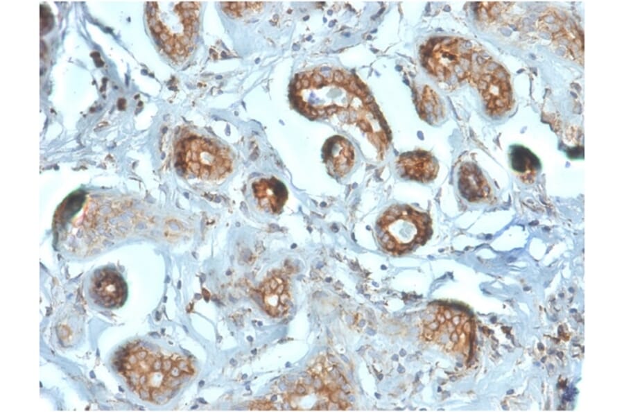 Immunohistochemistry - Anti-67kDa Laminin Receptor Antibody [RPSA/2699] - BSA and Azide free (A252404) - Antibodies.com