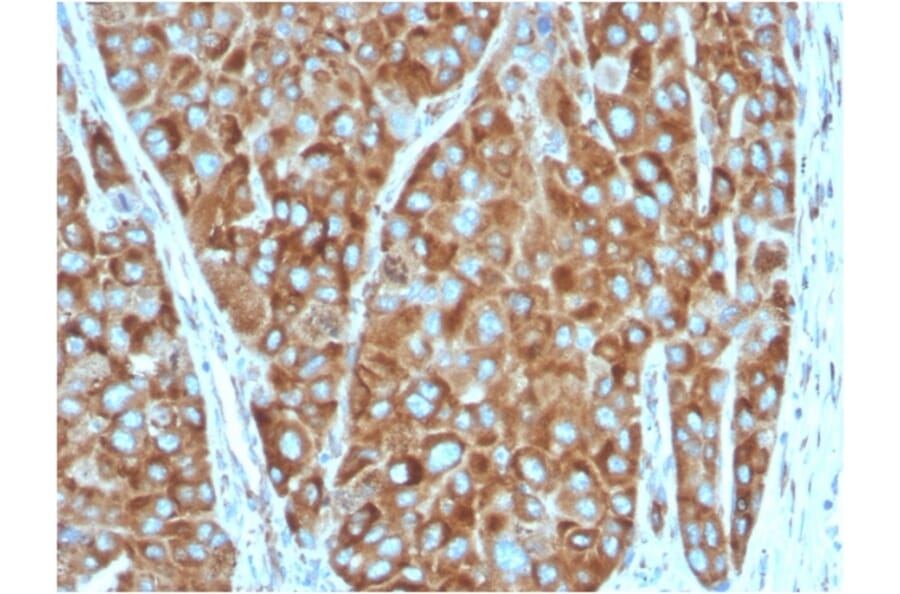 Immunohistochemistry - Anti-67kDa Laminin Receptor Antibody [RPSA/2699] - BSA and Azide free (A252404) - Antibodies.com