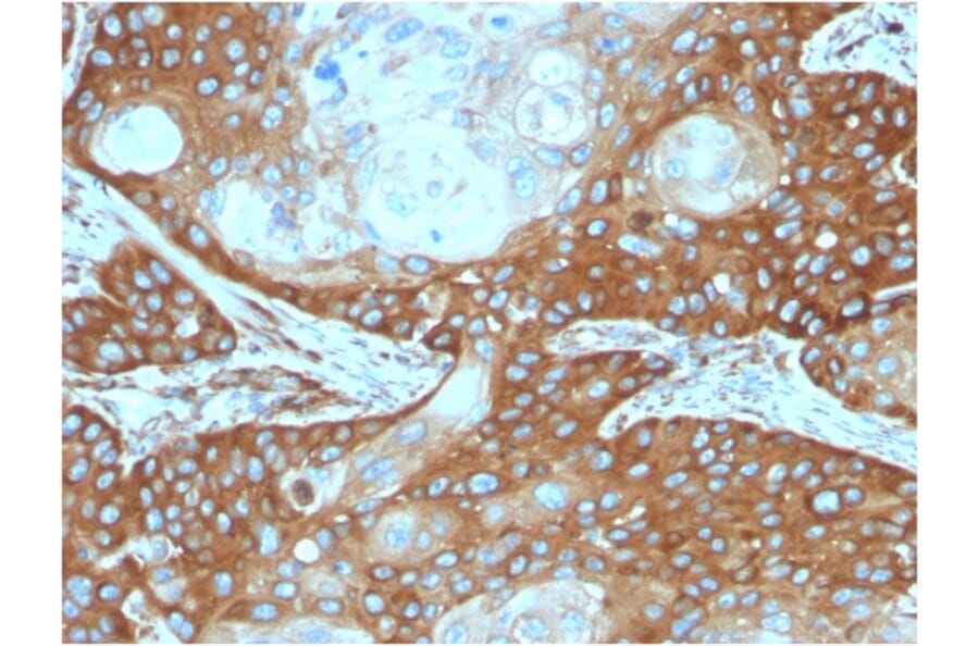Immunohistochemistry - Anti-67kDa Laminin Receptor Antibody [RPSA/2699] - BSA and Azide free (A252404) - Antibodies.com