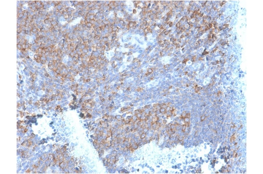 Immunohistochemistry - Anti-67kDa Laminin Receptor Antibody [RPSA/2699] - BSA and Azide free (A252404) - Antibodies.com