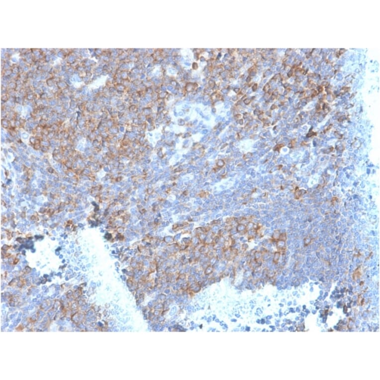 Immunohistochemistry - Anti-67kDa Laminin Receptor Antibody [RPSA/2699] - BSA and Azide free (A252404) - Antibodies.com