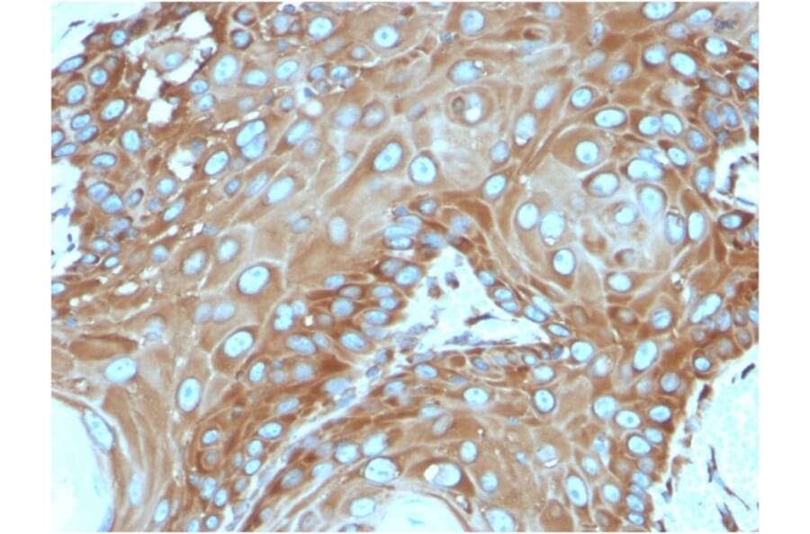 Immunohistochemistry - Anti-67kDa Laminin Receptor Antibody [RPSA/2699] - BSA and Azide free (A252404) - Antibodies.com