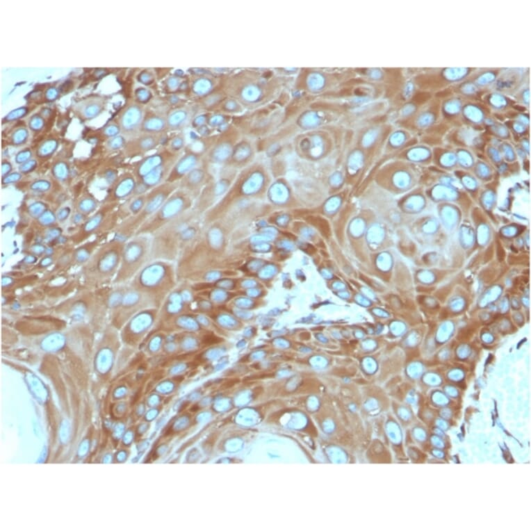 Immunohistochemistry - Anti-67kDa Laminin Receptor Antibody [RPSA/2699] - BSA and Azide free (A252404) - Antibodies.com