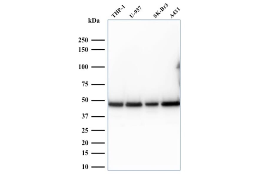 Western Blot - Anti-67kDa Laminin Receptor Antibody [RPSA/2699] - BSA and Azide free (A252404) - Antibodies.com