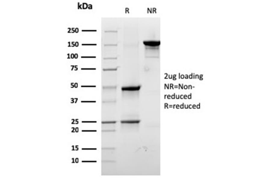 SDS-PAGE - Anti-67kDa Laminin Receptor Antibody [RPSA/2699] - BSA and Azide free (A252404) - Antibodies.com