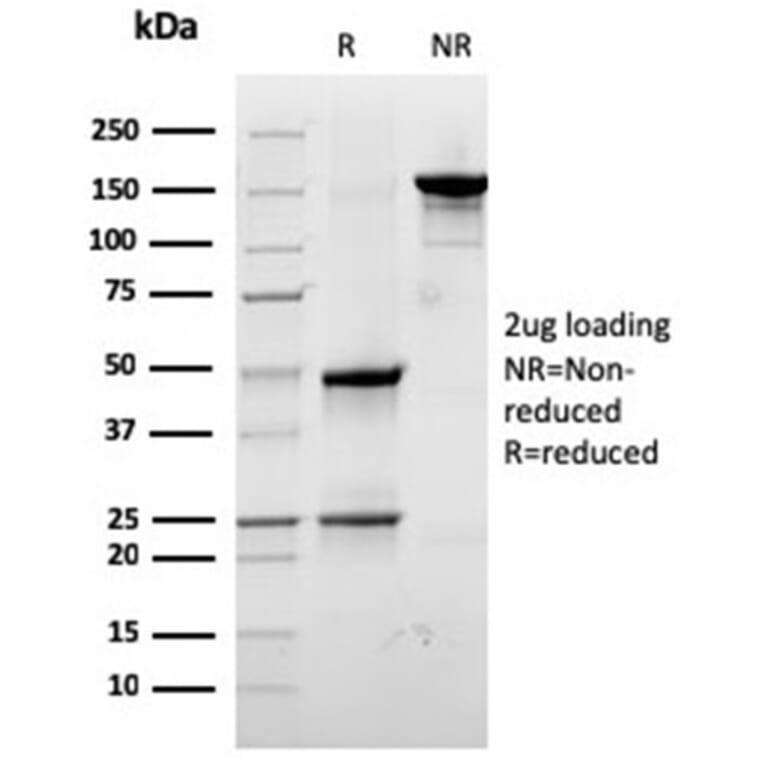 SDS-PAGE - Anti-67kDa Laminin Receptor Antibody [RPSA/2699] - BSA and Azide free (A252404) - Antibodies.com