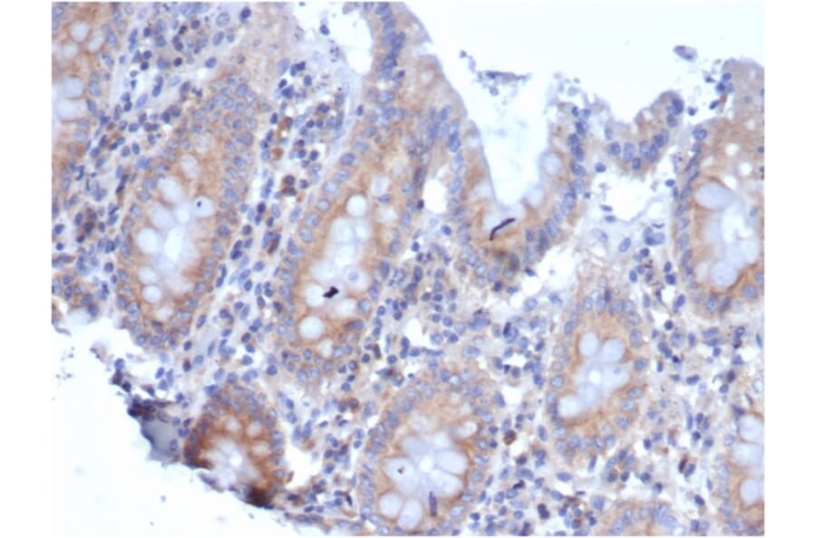 Immunohistochemistry - Anti-67kDa Laminin Receptor Antibody [rRPSA/6333] - BSA and Azide free (A252405) - Antibodies.com