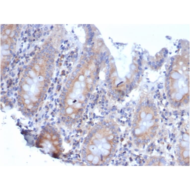 Immunohistochemistry - Anti-67kDa Laminin Receptor Antibody [rRPSA/6333] - BSA and Azide free (A252405) - Antibodies.com