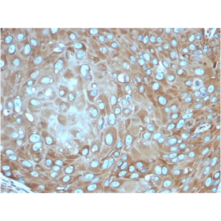 Immunohistochemistry - Anti-67kDa Laminin Receptor Antibody [rRPSA/6333] - BSA and Azide free (A252405) - Antibodies.com